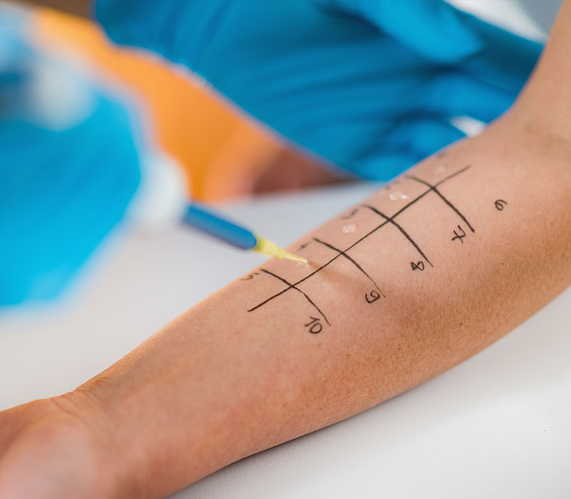Allergologia e immunologia