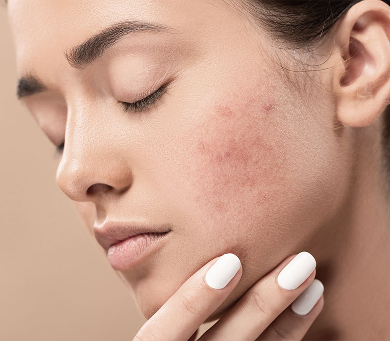 Dermatologia e venereologia